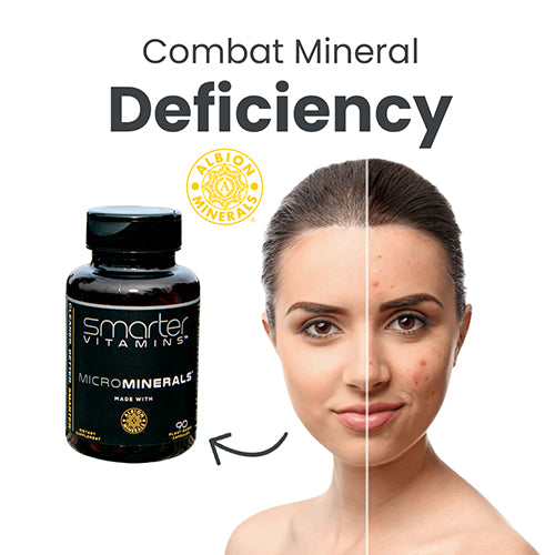 Combat mineral deficiency with Smarter MicroMinerals